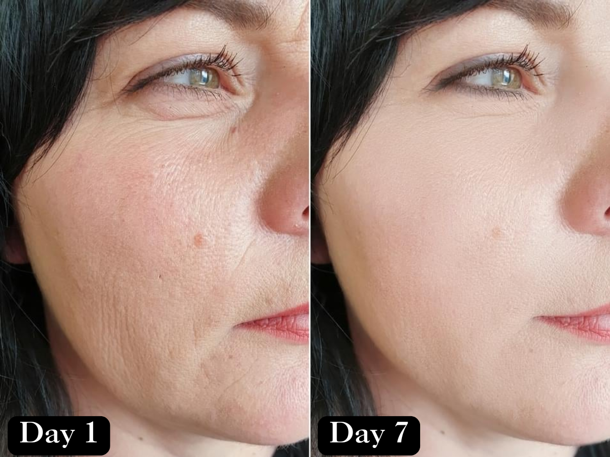 Before and after results showing reduced wrinkles